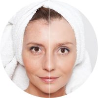 skin disorder restoration